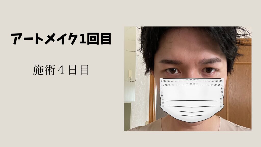 アートメイク1回目４日目